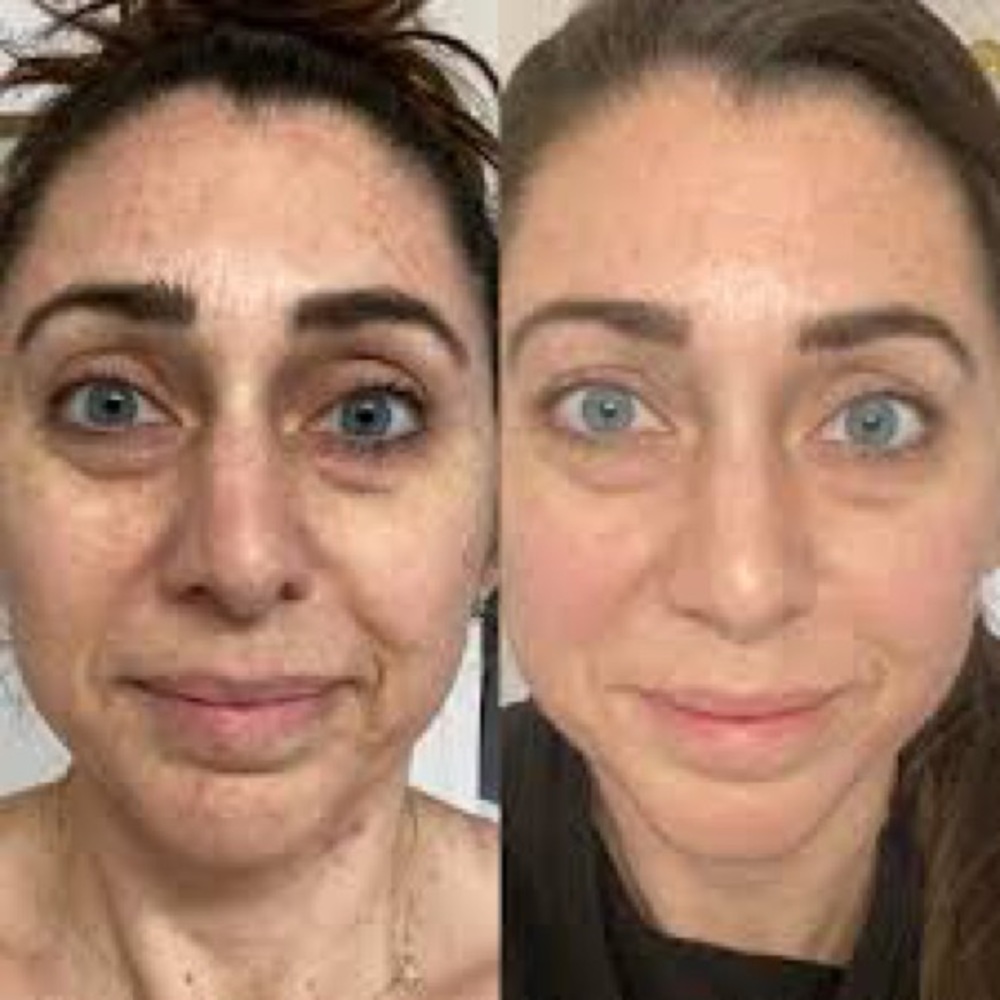 COPY - Collagen Elixir - Picture 5 of 11
